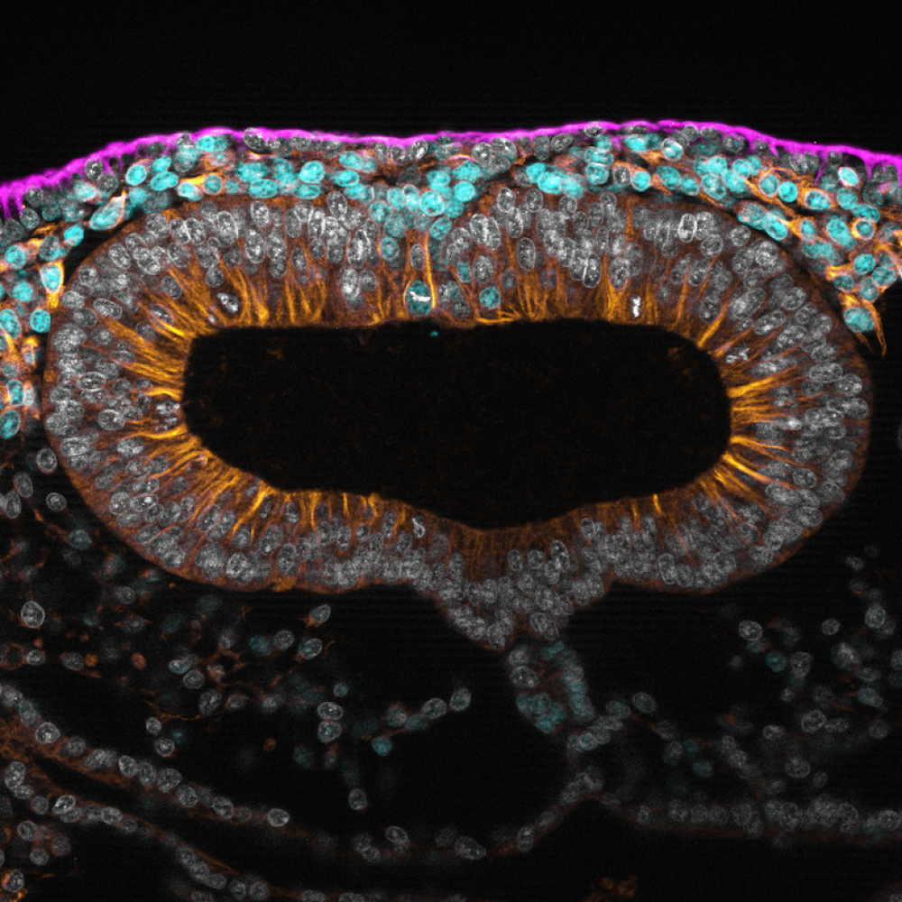 neural crest cell