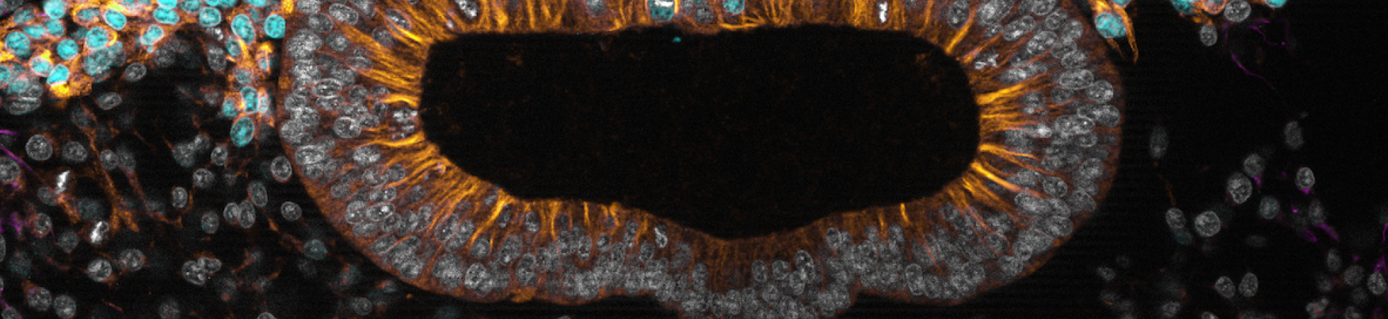 neural crest cell